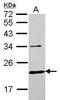 Charged Multivesicular Body Protein 6 antibody, GTX116824, GeneTex, Western Blot image 