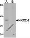 NK2 Homeobox 2 antibody, 6743, ProSci, Western Blot image 