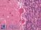 Autophagy Related 5 antibody, LS-B11793, Lifespan Biosciences, Immunohistochemistry frozen image 