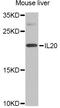 Interleukin 17B antibody, STJ28712, St John