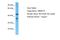 Transmembrane Protein 116 antibody, A18144, Boster Biological Technology, Western Blot image 