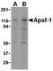 Apoptotic Peptidase Activating Factor 1 antibody, orb75847, Biorbyt, Western Blot image 