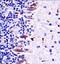 Mitogen-activated protein kinase kinase kinase MLK4 antibody, GTX53632, GeneTex, Immunohistochemistry paraffin image 