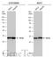 Ribosomal Protein S6 antibody, GTX130450, GeneTex, Western Blot image 