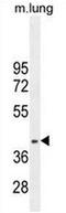 Ring Finger Protein 215 antibody, AP53690PU-N, Origene, Western Blot image 