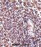Hematopoietic Cell-Specific Lyn Substrate 1 antibody, abx027757, Abbexa, Immunohistochemistry frozen image 