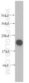 Coenzyme Q7, Hydroxylase antibody, 15083-1-AP, Proteintech Group, Western Blot image 