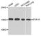 Eva-1 Homolog A, Regulator Of Programmed Cell Death antibody, A8070, ABclonal Technology, Western Blot image 