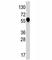 Interleukin 1 Receptor Type 1 antibody, F49605-0.4ML, NSJ Bioreagents, Western Blot image 