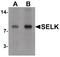 Selenoprotein K antibody, PA5-34420, Invitrogen Antibodies, Western Blot image 