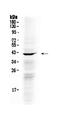 NDRG Family Member 3 antibody, A10017, Boster Biological Technology, Western Blot image 