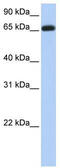 Ectonucleoside Triphosphate Diphosphohydrolase 7 antibody, TA338413, Origene, Western Blot image 