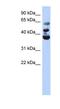 NOP2/Sun RNA Methyltransferase 3 antibody, NBP1-55169, Novus Biologicals, Western Blot image 