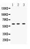 TNF Receptor Superfamily Member 10b antibody, A00410, Boster Biological Technology, Western Blot image 