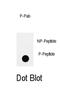 Insulin Receptor Substrate 2 antibody, abx032045, Abbexa, Dot Blot image 