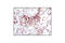 Hematopoietic Cell-Specific Lyn Substrate 1 antibody, 3890P, Cell Signaling Technology, Immunohistochemistry paraffin image 