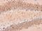 CTF antibody, NBP2-15039, Novus Biologicals, Immunohistochemistry paraffin image 