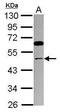 Thyroid Hormone Receptor Interactor 13 antibody, PA5-31542, Invitrogen Antibodies, Western Blot image 