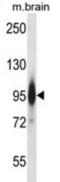 Protein Kinase C Epsilon antibody, abx028191, Abbexa, Western Blot image 