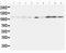 EPH Receptor A1 antibody, LS-C312729, Lifespan Biosciences, Western Blot image 