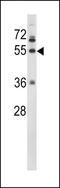 Fibrinogen Gamma Chain antibody, LS-C99315, Lifespan Biosciences, Western Blot image 