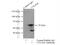 Collagen Type IV Alpha 6 Chain antibody, 10807-1-AP, Proteintech Group, Immunoprecipitation image 