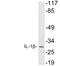 Interleukin 1 Beta antibody, LS-C286297, Lifespan Biosciences, Western Blot image 