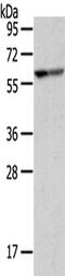 Involucrin antibody, TA351501, Origene, Western Blot image 