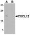 C-X-C Motif Chemokine Ligand 12 antibody, A00053-3, Boster Biological Technology, Western Blot image 