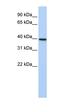 TIA1 Cytotoxic Granule Associated RNA Binding Protein antibody, orb330154, Biorbyt, Western Blot image 