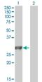 Myosin IIIA antibody, H00053904-B01P, Novus Biologicals, Western Blot image 