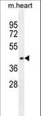 Adaptor Related Protein Complex 1 Subunit Mu 1 antibody, LS-C156381, Lifespan Biosciences, Western Blot image 