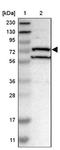 DExH-Box Helicase 58 antibody, NBP1-85348, Novus Biologicals, Western Blot image 