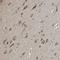 E3 ubiquitin-protein ligase MIB1 antibody, HPA019100, Atlas Antibodies, Immunohistochemistry paraffin image 