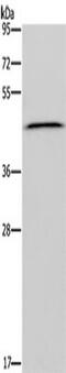 Epithelial Stromal Interaction 1 antibody, TA349937, Origene, Western Blot image 