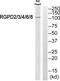 RANBP2 Like And GRIP Domain Containing 3 antibody, PA5-39396, Invitrogen Antibodies, Western Blot image 