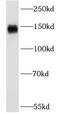 Coagulation factor V antibody, FNab02923, FineTest, Western Blot image 