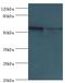 Alkaline Phosphatase, Placental antibody, LS-C375213, Lifespan Biosciences, Western Blot image 