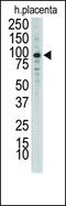 Discoidin Domain Receptor Tyrosine Kinase 1 antibody, PA5-14698, Invitrogen Antibodies, Western Blot image 