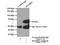 Insulin Like Growth Factor 2 MRNA Binding Protein 1 antibody, 22803-1-AP, Proteintech Group, Immunoprecipitation image 