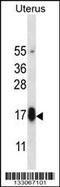 Glycoprotein Hormone Subunit Beta 5 antibody, 56-936, ProSci, Western Blot image 