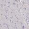 Stress Induced Phosphoprotein 1 antibody, NBP2-33411, Novus Biologicals, Immunohistochemistry paraffin image 