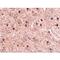 Mitochondrial import receptor subunit TOM70 antibody, LS-C82899, Lifespan Biosciences, Immunohistochemistry frozen image 