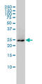 Growth Factor Receptor Bound Protein 2 antibody, LS-C197345, Lifespan Biosciences, Western Blot image 