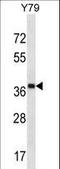 CAP-Gly Domain Containing Linker Protein Family Member 4 antibody, LS-C168843, Lifespan Biosciences, Western Blot image 