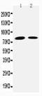 Transglutaminase 2 antibody, PA2153, Boster Biological Technology, Western Blot image 