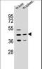 Acyl-CoA Wax Alcohol Acyltransferase 2 antibody, LS-C156696, Lifespan Biosciences, Western Blot image 