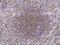 Lymphocyte Cytosolic Protein 1 antibody, GTX02284, GeneTex, Immunohistochemistry paraffin image 