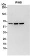 Zinc Finger Protein 622 antibody, NBP2-32087, Novus Biologicals, Immunoprecipitation image 