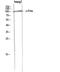 Colony Stimulating Factor 1 Receptor antibody, STJ92243, St John